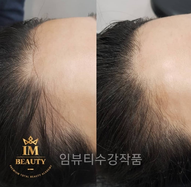 임뷰티 이미지