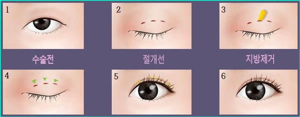 셀럽성형외과의원 이미지