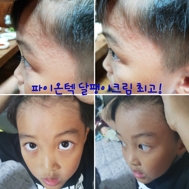 파이온택 이미지