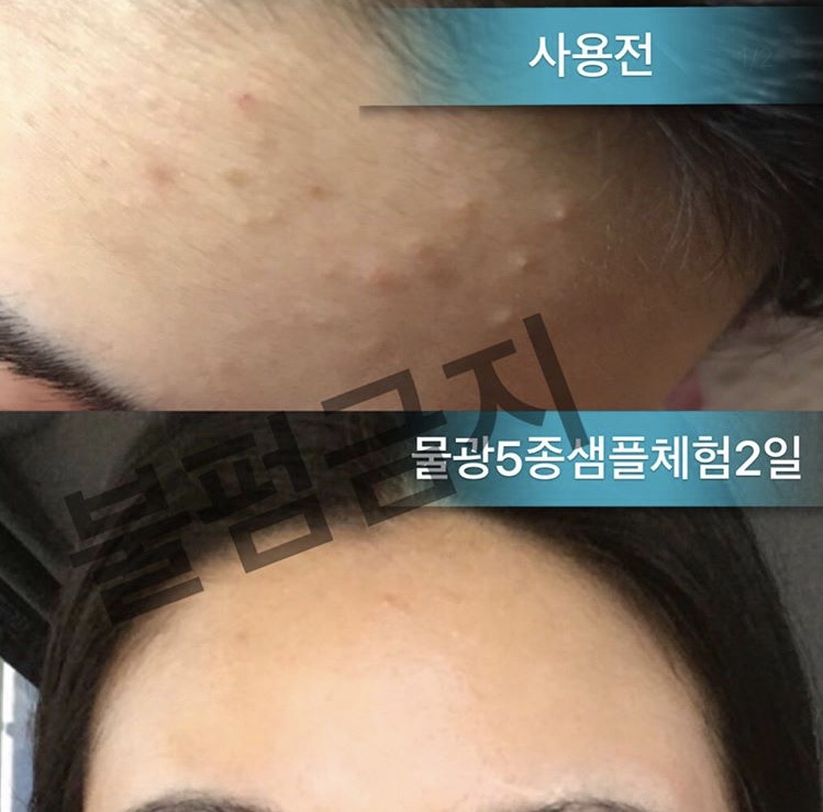 파이온택 이미지