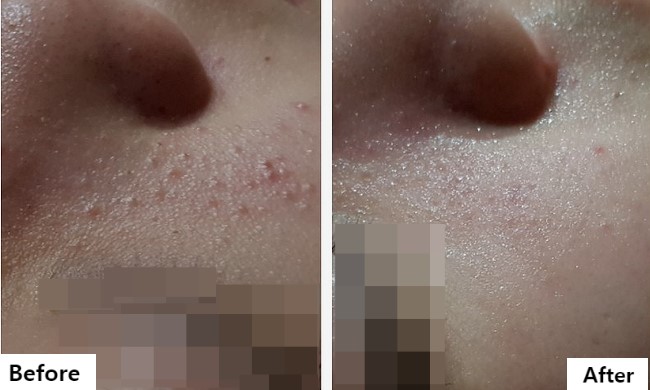 스파체형관리 이미지