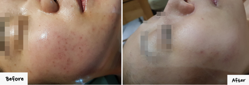 스파체형관리 이미지