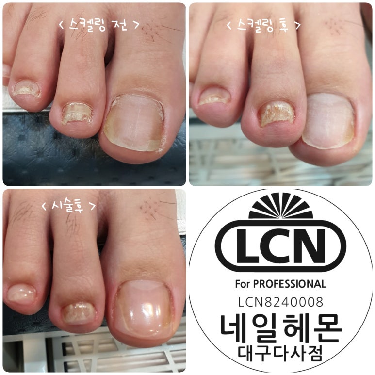 네일헤몬대구 이미지