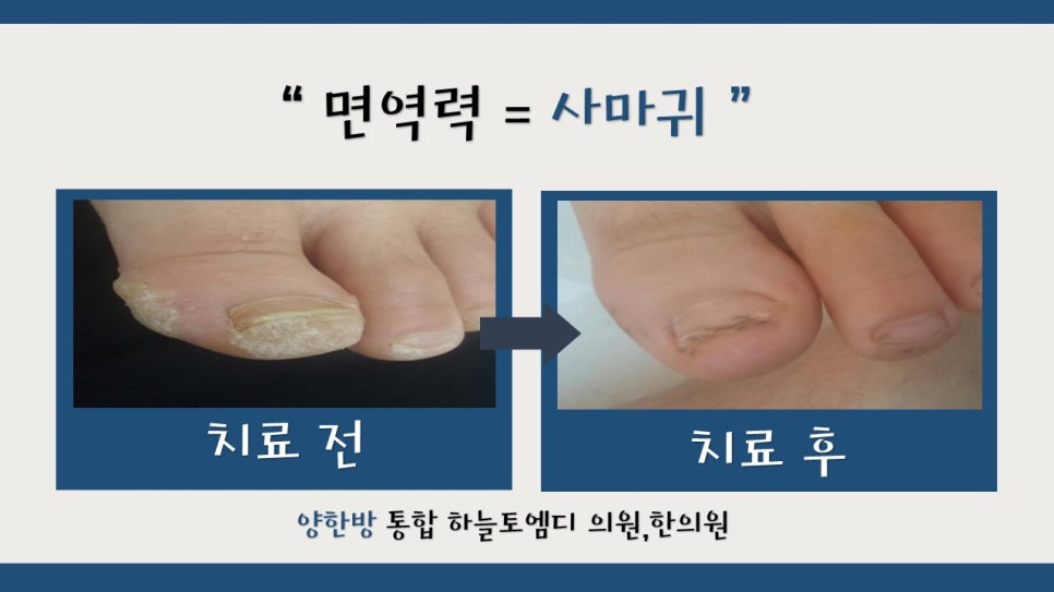 하늘토엠디의원;하늘토엠디한의원 이미지