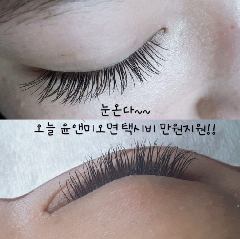 윤피부토탈관리 이미지