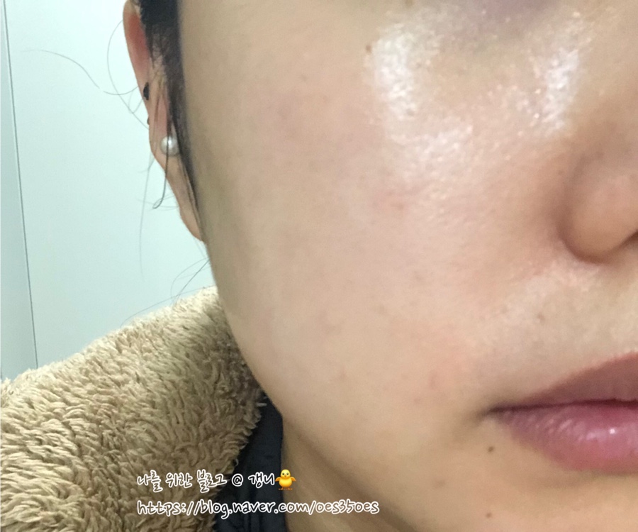 비케이로웰 이미지