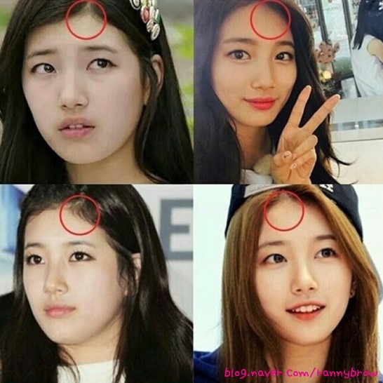 라니헤어 이미지
