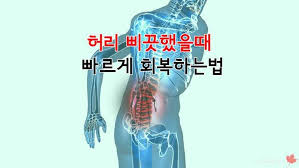 니드핏 이미지