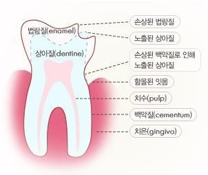 민치과 이미지