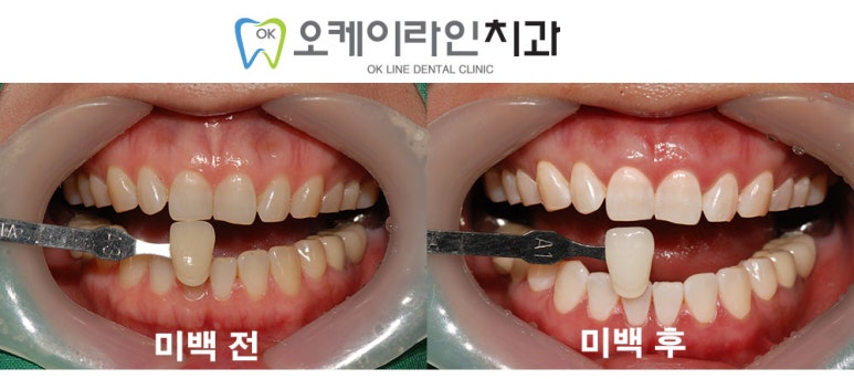 오케이라인치과 이미지