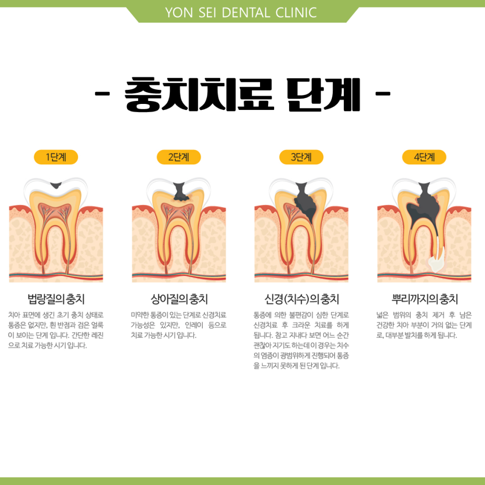 비앤이 이미지