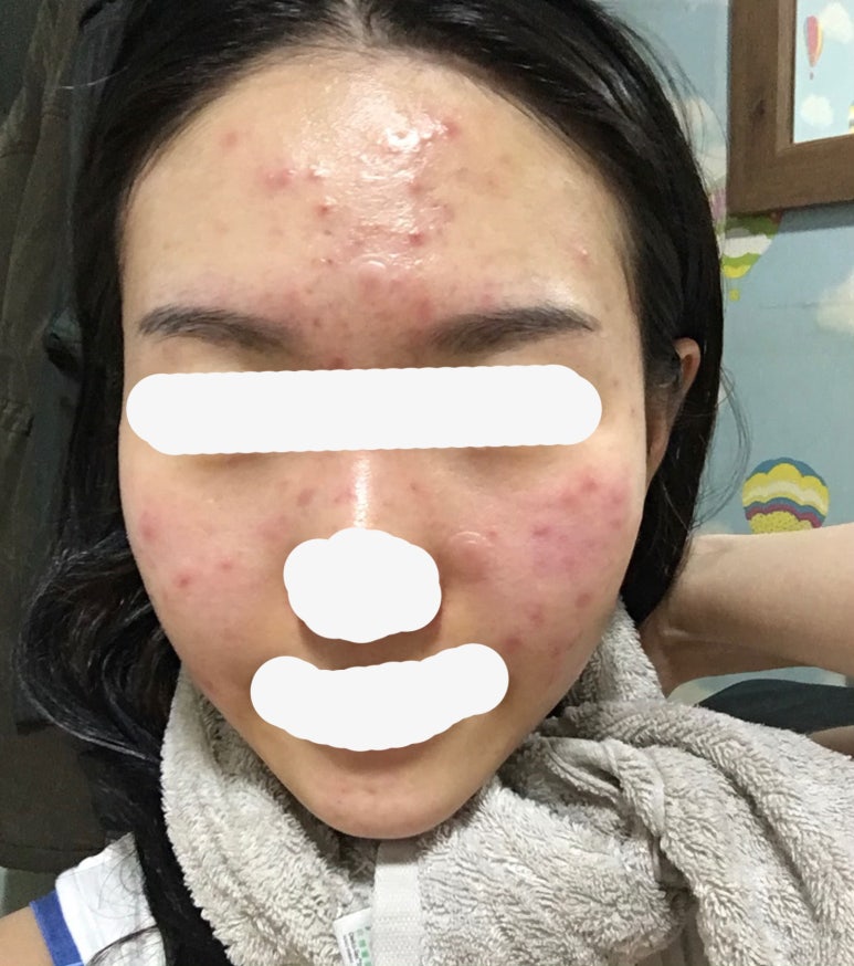 피디티 이미지