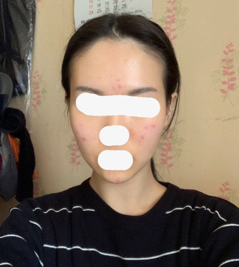 피디티 이미지
