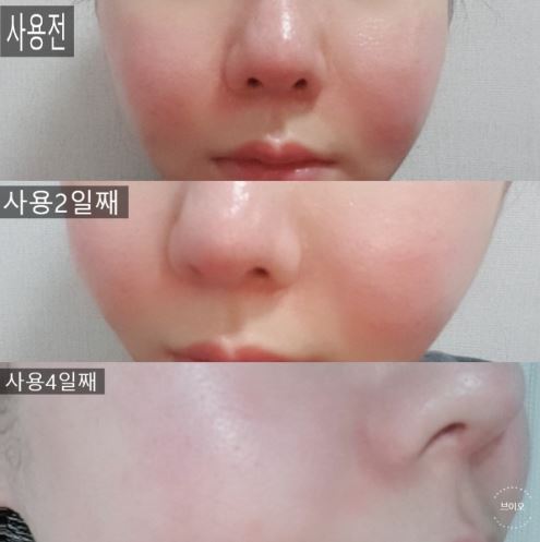 맑은클린 이미지