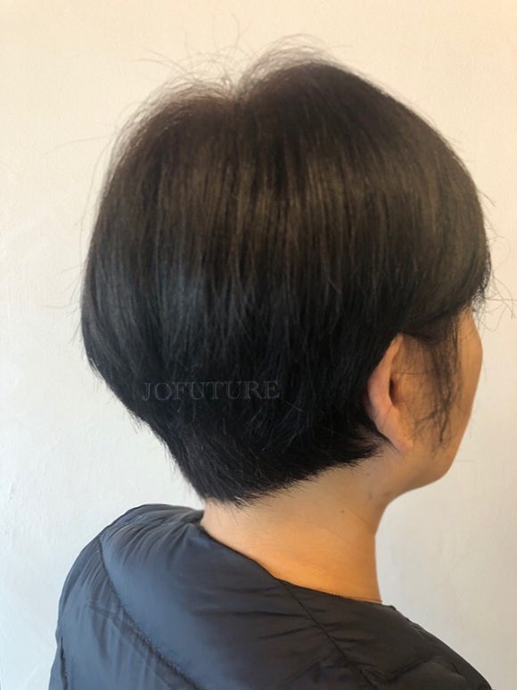 조헤어라인 이미지