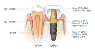민치과의원 이미지
