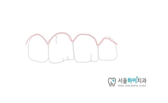 서울하이치과 이미지