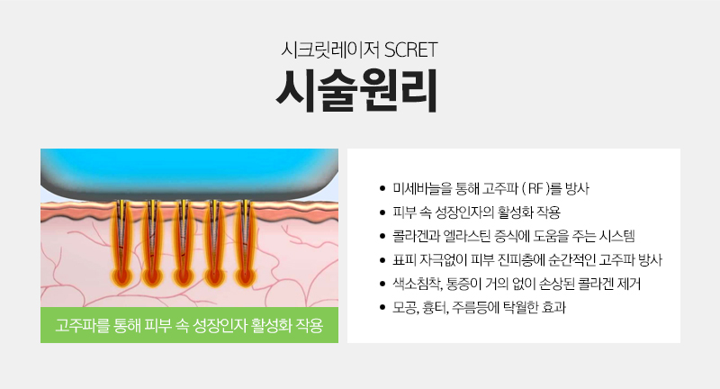 아그네스 이미지