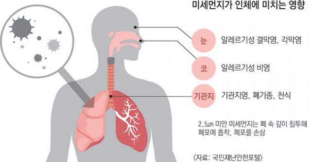 크린시스 이미지