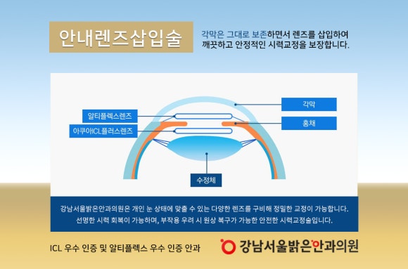 밝은서울안과의원 이미지