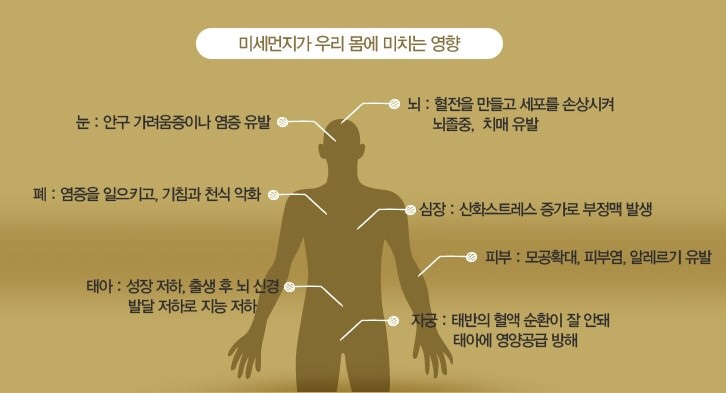 크린시스 이미지