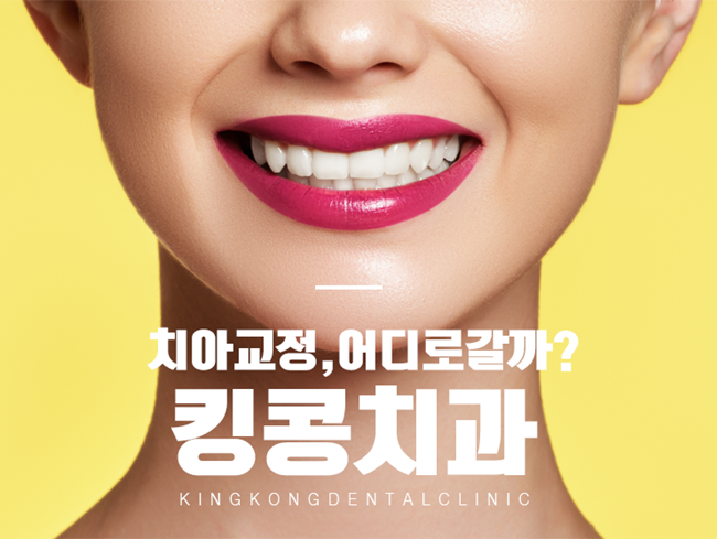 스티치킹콩 이미지