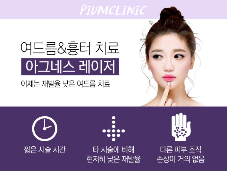 아그네스 이미지