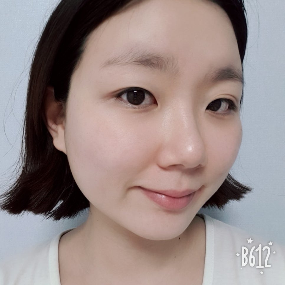 동막골피부 이미지