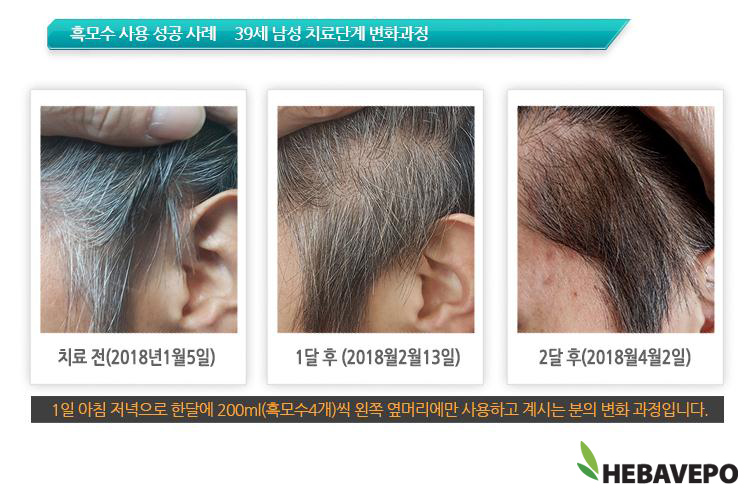 헤바베오 (Hebavepo) 이미지