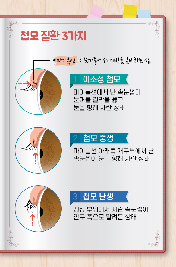 고양이속눈썹 이미지