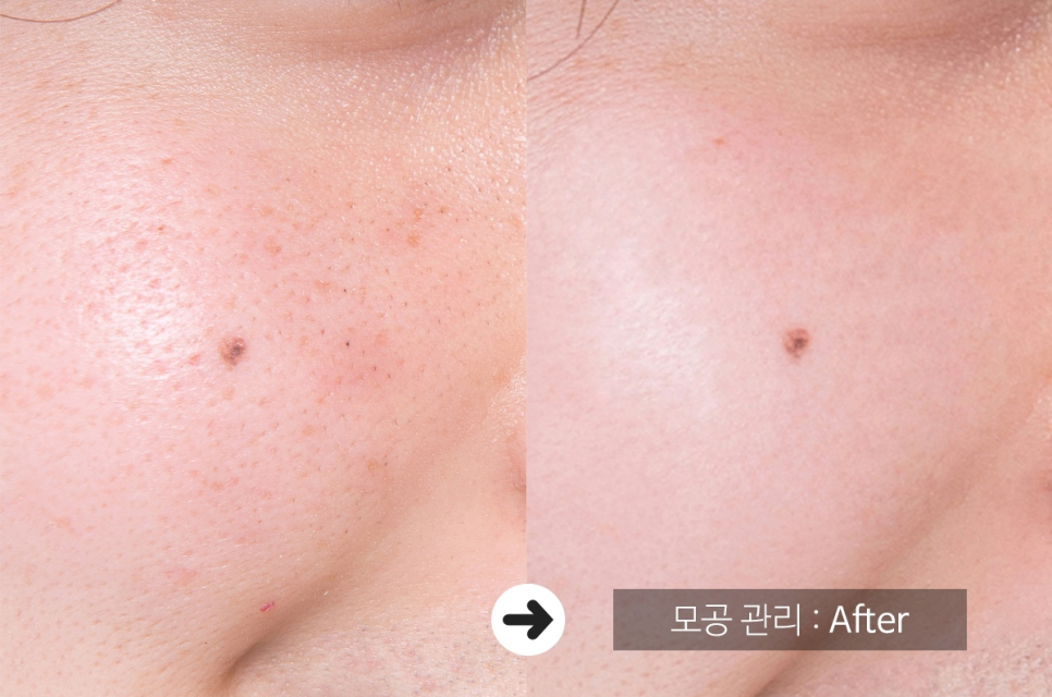 빵긋홈케어 이미지