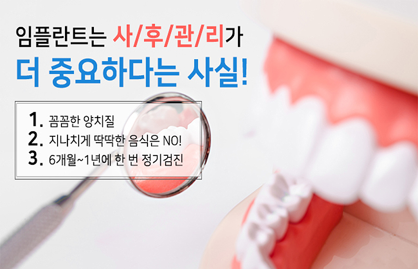 송*호 이미지