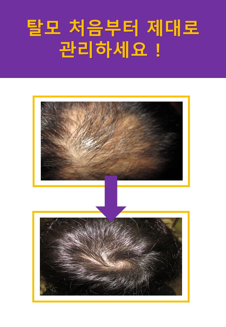 하늘토엠디의원;하늘토엠디한의원 이미지