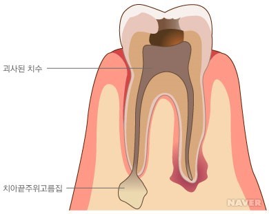 연세윤치과 이미지