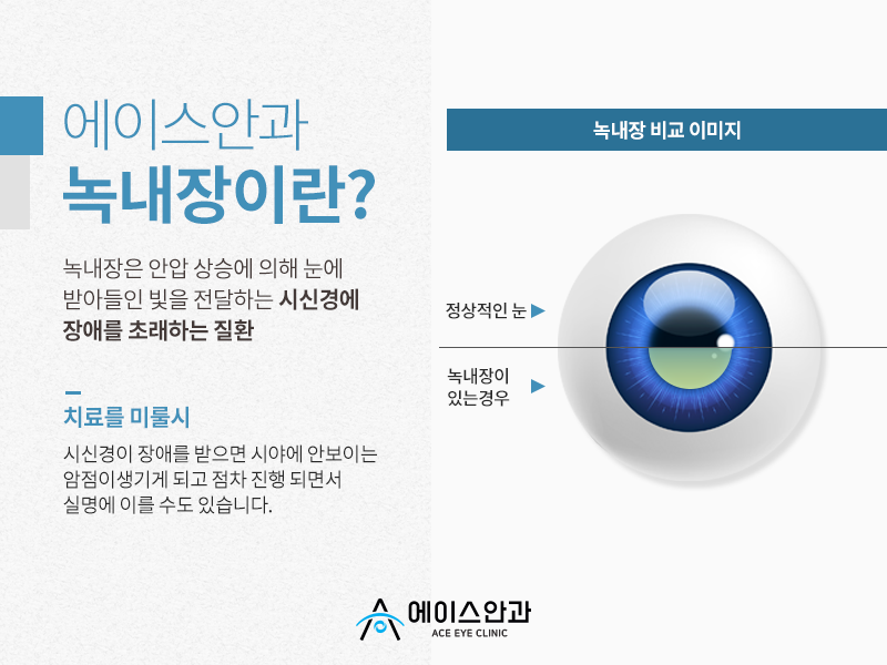 에이스안과의원 이미지