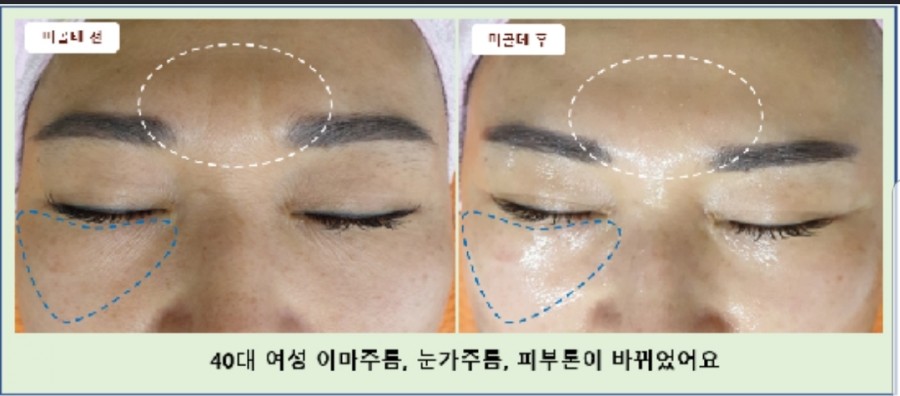 라파테라피 이미지