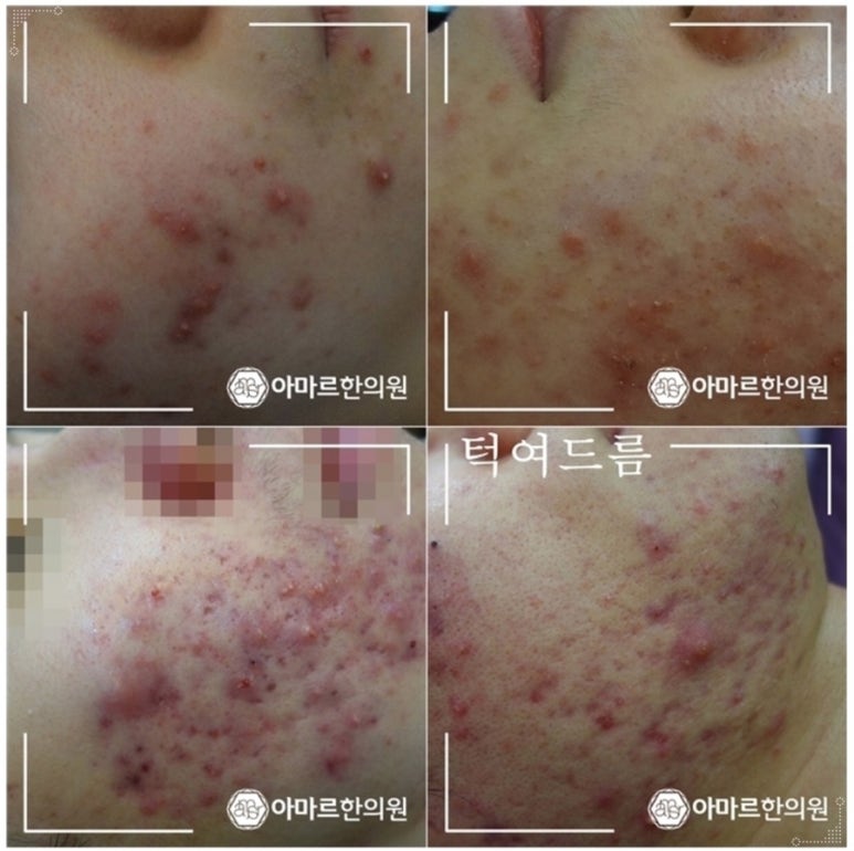 아마르한의원 이미지