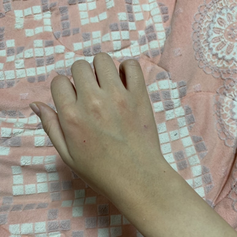 망고짠지 이미지