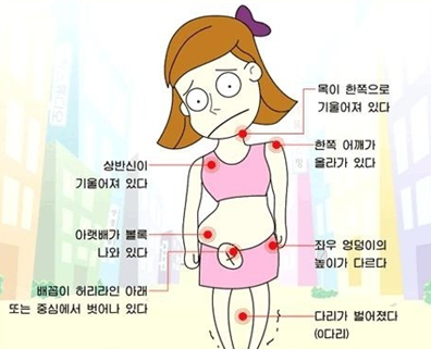 바디체인지체형교정 이미지