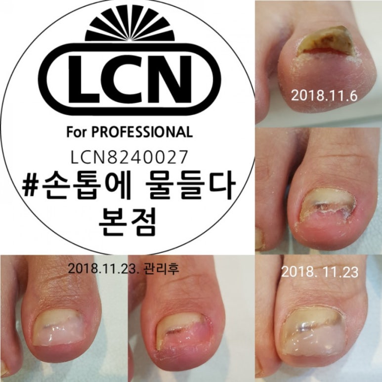 더샵네일in 이미지