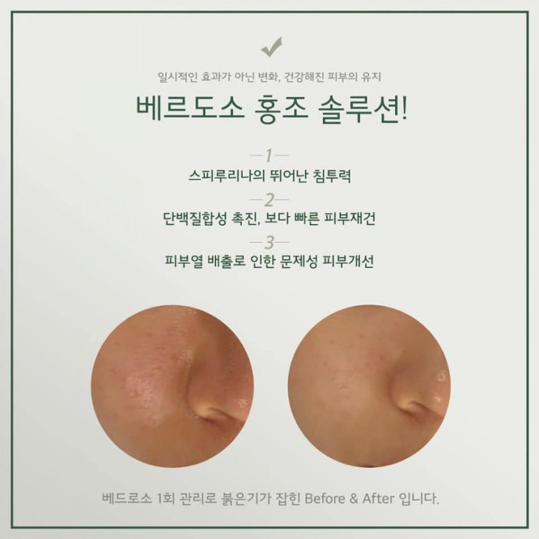 피부살리기 이미지