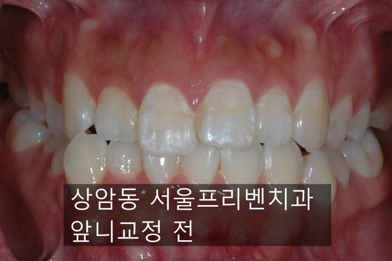 서울프리벤치과의원 이미지