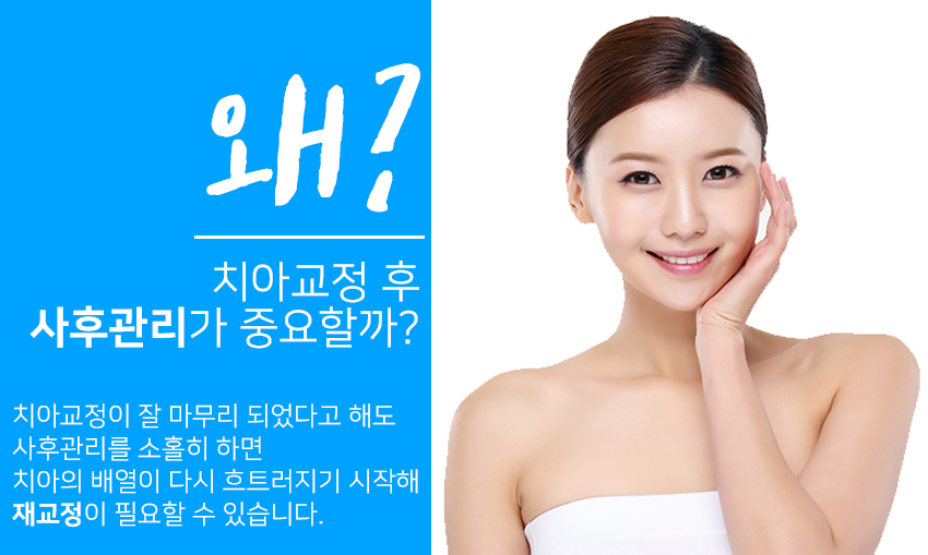 스티치킹콩 이미지
