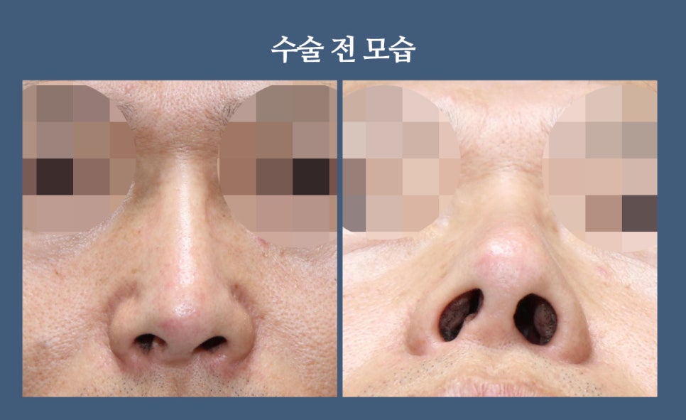비주 이미지