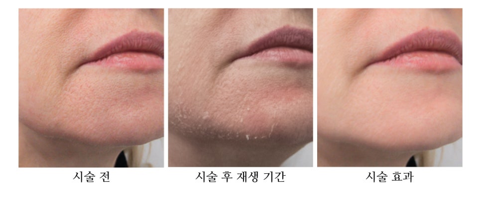 브라운필 이미지
