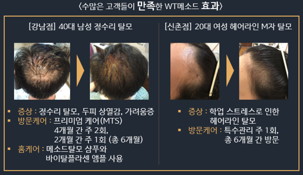 독일WT메소드 이미지