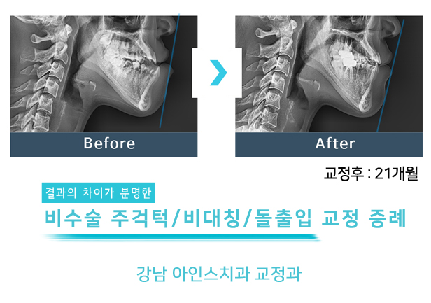 아인스치과의원 이미지