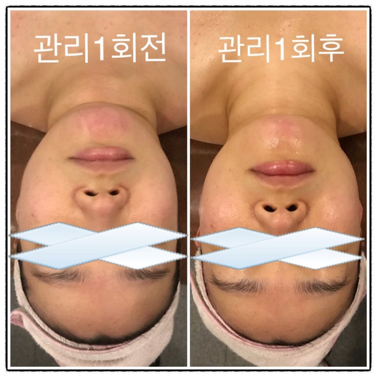 진선미피부 이미지