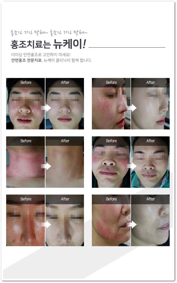 뉴케이의원 이미지