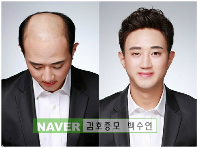 헤어폼 이미지